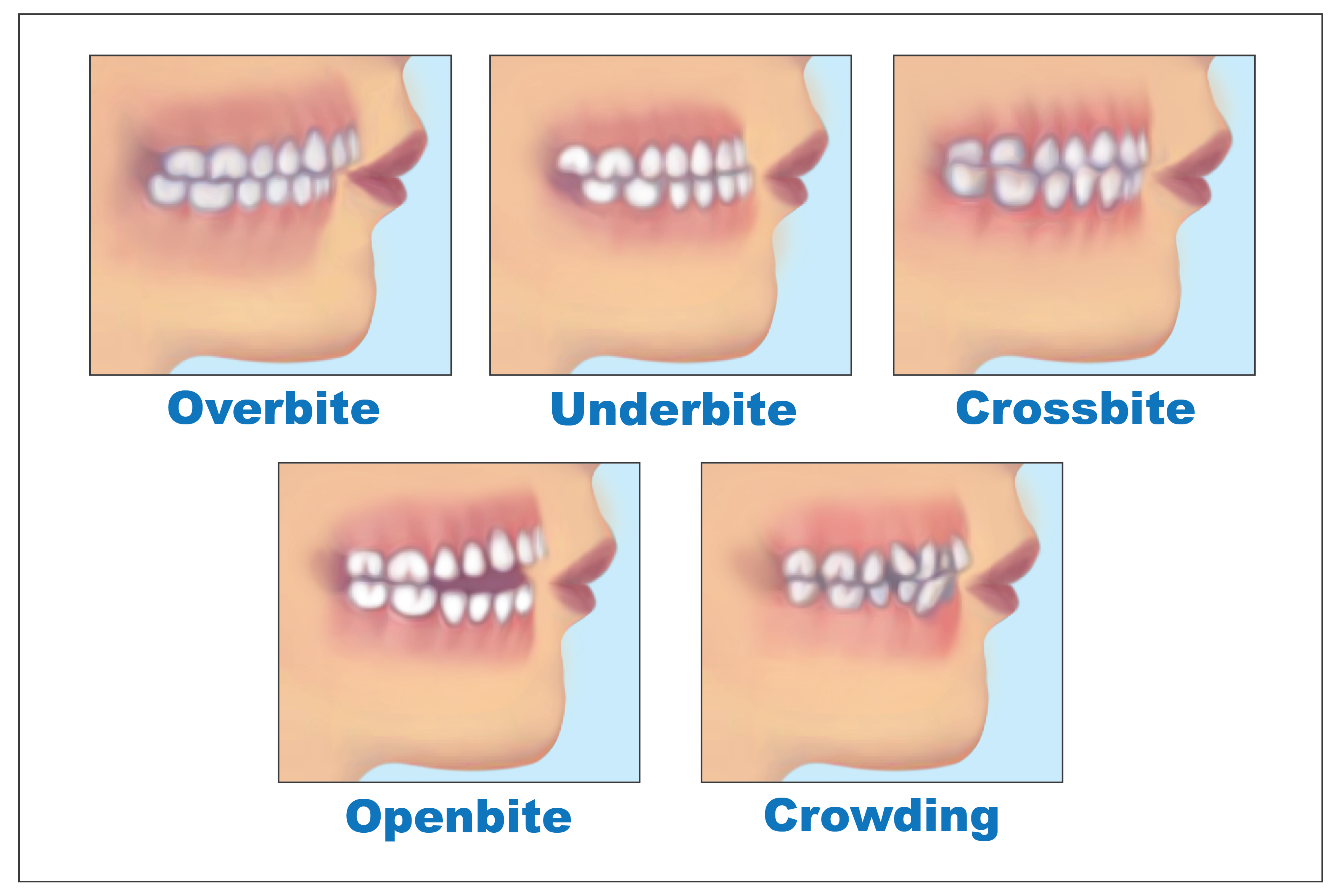 Orthodontics Teaching Method at Joan Johns blog