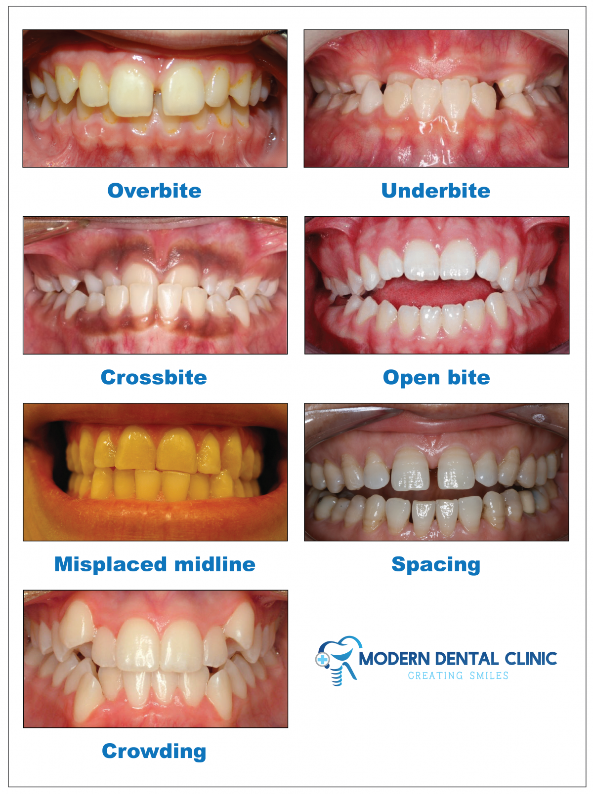 ORTHODONTICS Modern Dental Clinic, Calicut